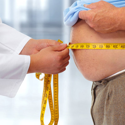 Bariatric Surgery